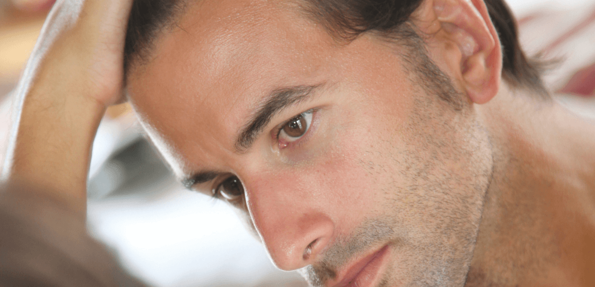 CADUTA DEI CAPELLI NEGLI UOMINI E NELLE DONNE
